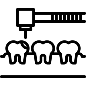 Contorneado dental clínica dental Valladolid
